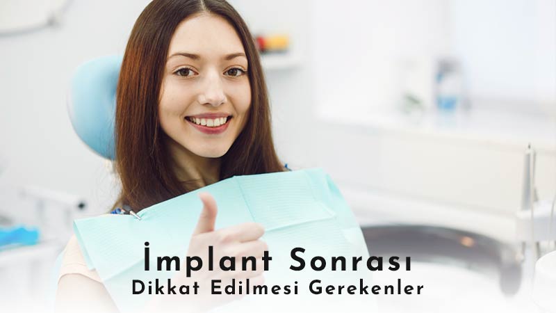 İmplant Diş Takıldıktan Sonra Dikkat Edilmesi Gerekenler