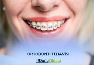 Ortodonti Tedavisi