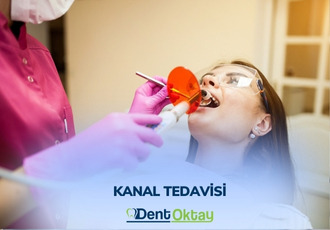 Yetişkinlerde Kanal Tedavisi