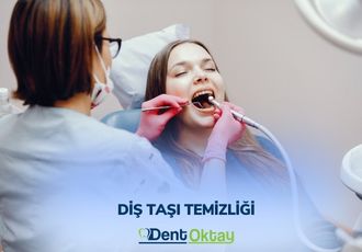 Diş Taşı Temizliği